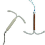 dispositivo intrauterino